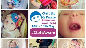 cleft palate awareness week
